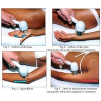 Noleggio ULTRASUONO TERAPIA